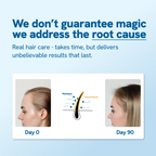 Advanced Hair Growth Serum Roll On (25ml)